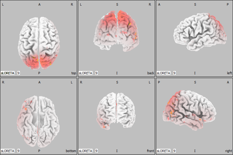 Amen Clinics & Peak Brain Partnership